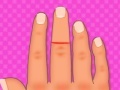 Žaidimas Finger surgery