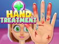 Žaidimas Hand Treatment